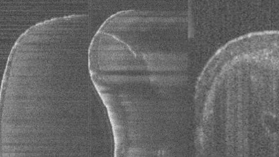 Visual information and imaging technology in endodontics