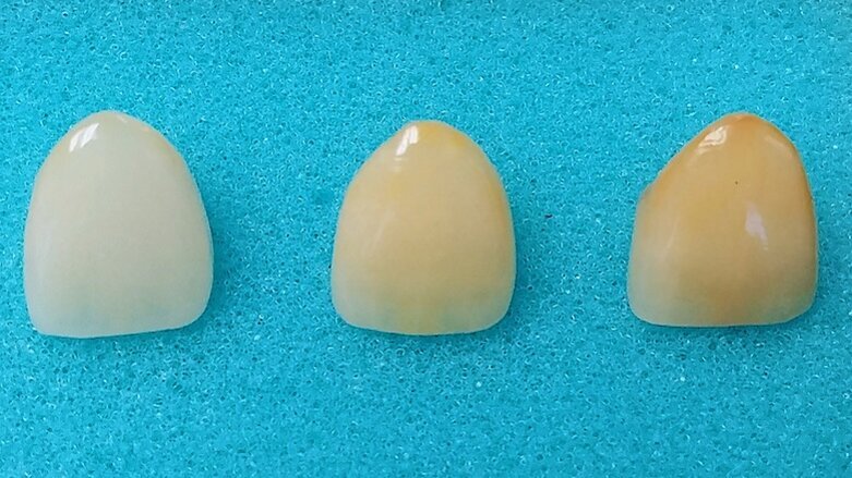 Las tres etapas de los dientes: Inocencia, madurez y sabiduría (1)