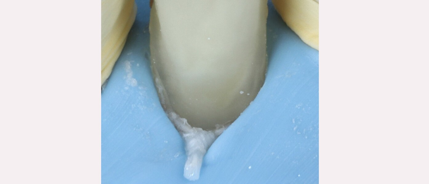 Fig. 20b: Close-up.
