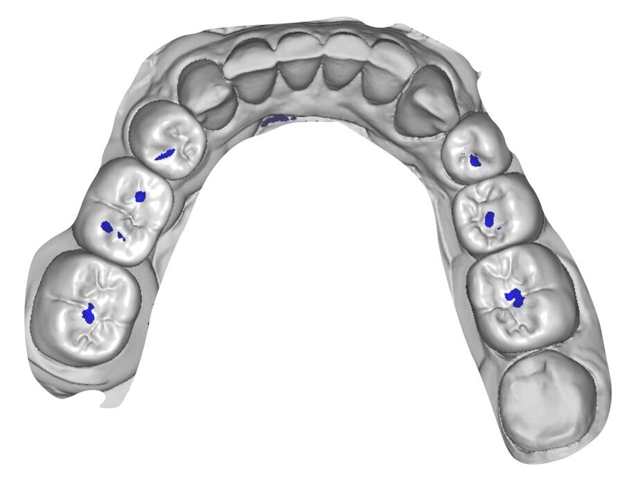 Fig. 32