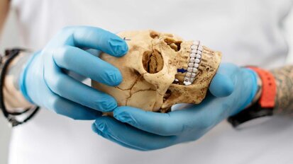 Nose, Sinus & Implants: Humanpräparatekurs und Weichgewebemanagement