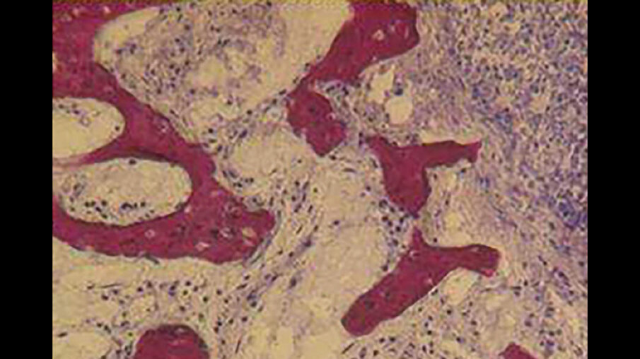 Fig. 22