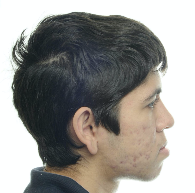 Fig. 42