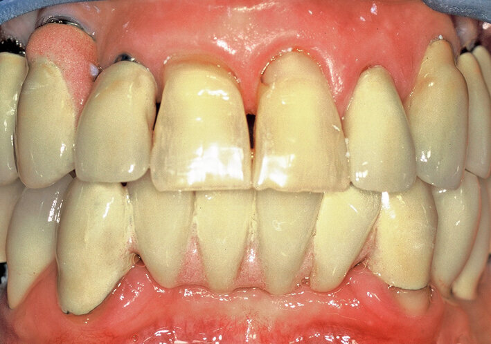 Fig. 4. 2nd consultation. Clinical view (front). 