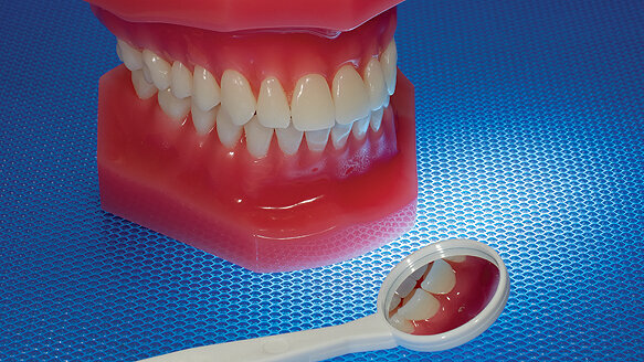 Genetic variation linked to increased periodontitis risk