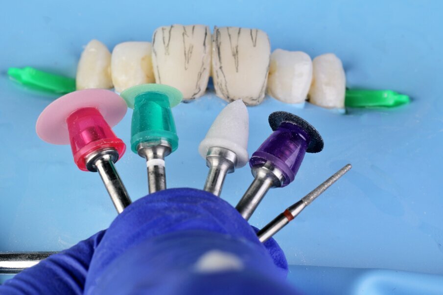 Fig. 13: Finishing and polishing protocol with a selection of  Fine Diamond Points for anatomical contouring,  Super-Snap Xtreme purple disk for fine finishing , OneGloss 2in1 Polisher for surface texture, Super Snap-Xtreme Green and Red disks for polishing.