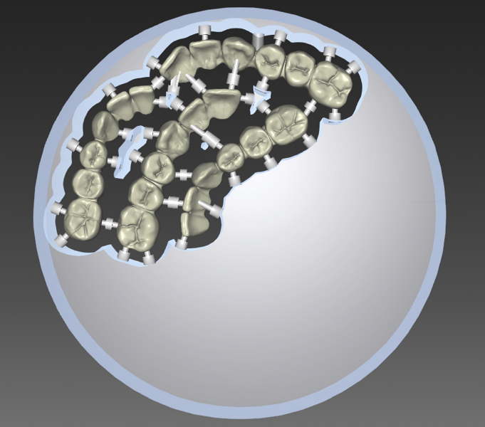 Fig. 17: Tooth segments connected to the blank via connectors in the nesting software. 