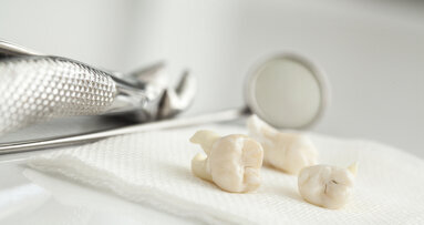 Indian dentists extract 526 teeth from boy’s mouth