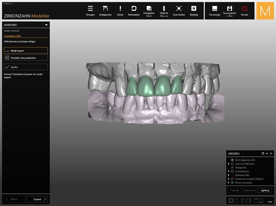 Fig. 6: Digital wax-up of the crowns.