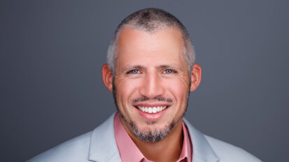 Why I changed how I plan clear aligner treatment (and why it may have changed forever)