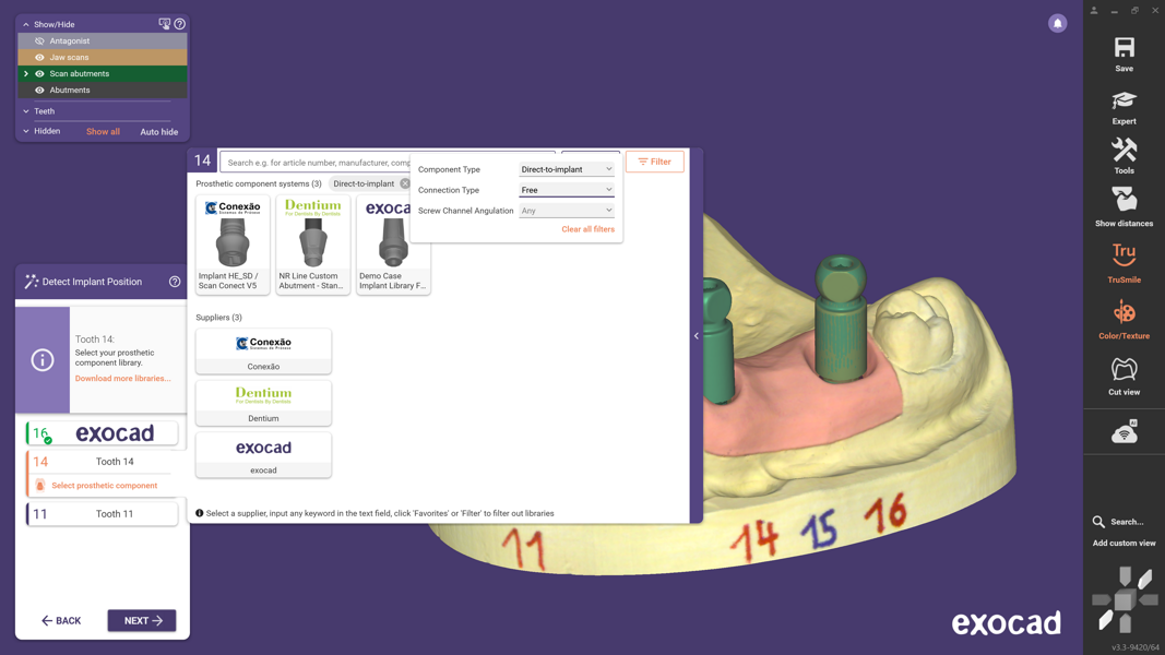 Fig. 4: Advanced filter options allow users to refine component selection by criteria such as component type, connection type and screw channel angulation.