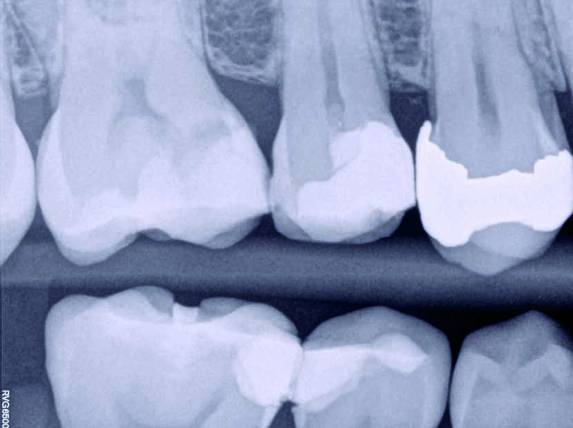 Fig. 16