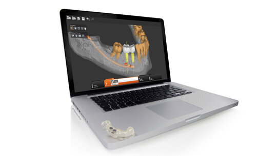 SimPlant® GO: il nuovo approccio all’implantologia dentale guidata