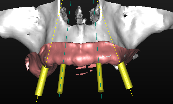 Fig. 13