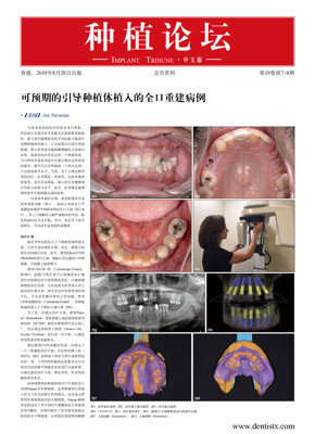 Implant Tribune China No. 4, 2019