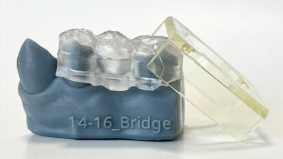 Researchers develop novel approach to dental restoration using 3D printing