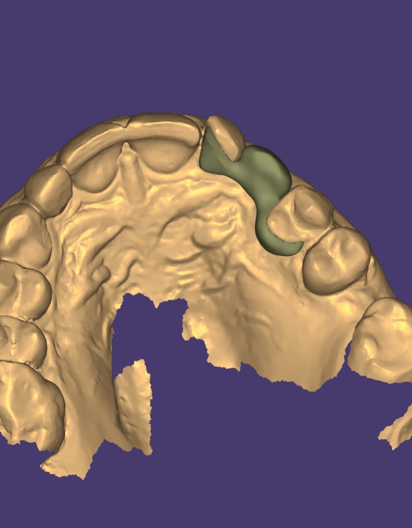Fig. 5