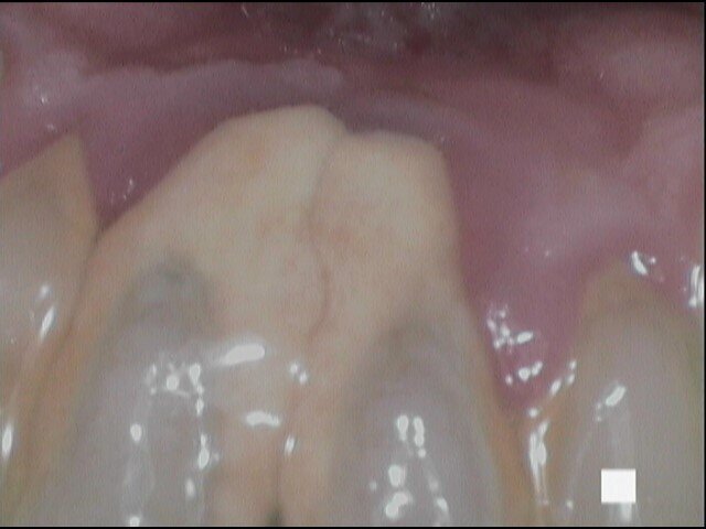 Fig. 2d