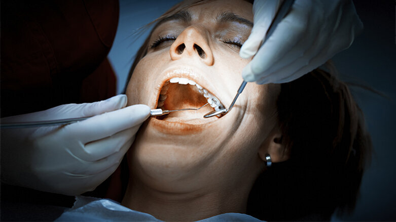 Study points to possible alternative to amalgam
