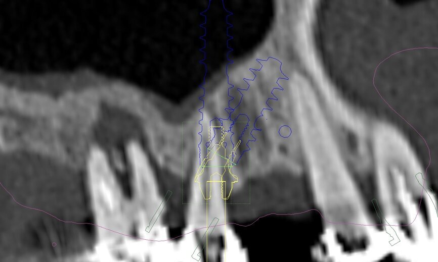 Fig. 14