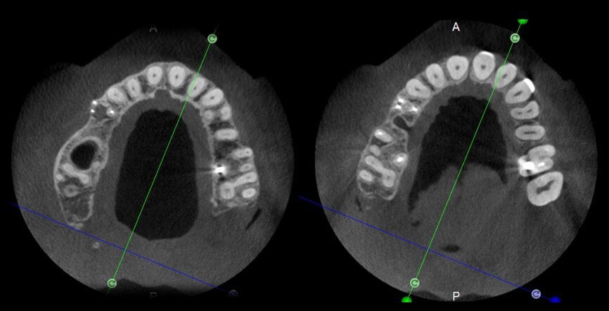 Fig. 25