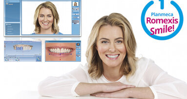 El mejor programa de Diseño de la Sonrisa