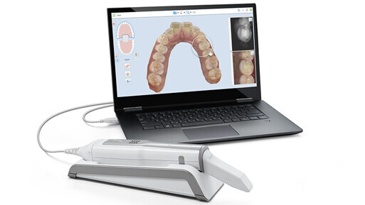 FDA clears Itero Element 5D Imaging System