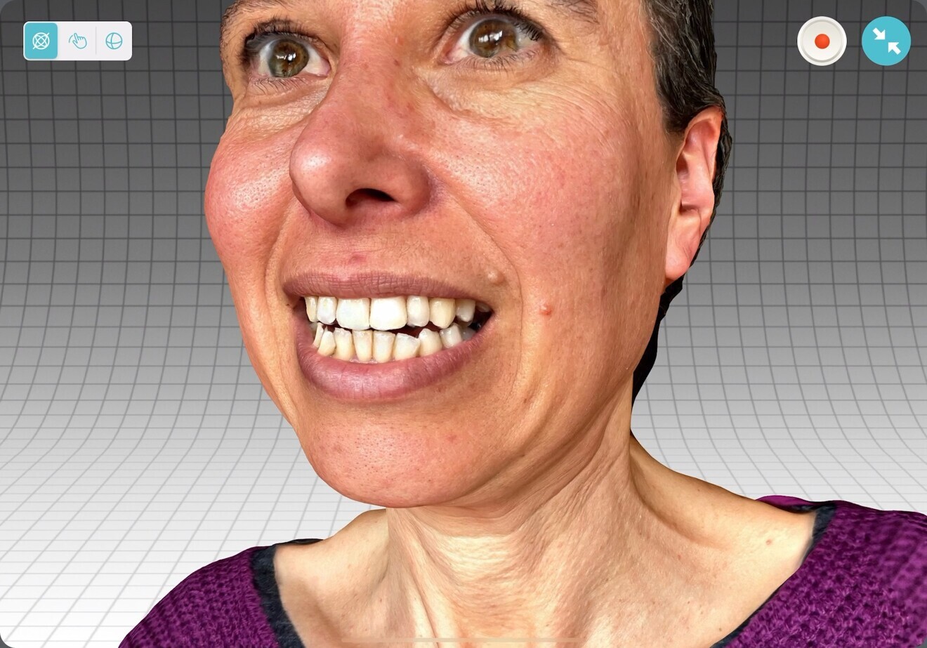 Fig. 3: Qlone face scan example.