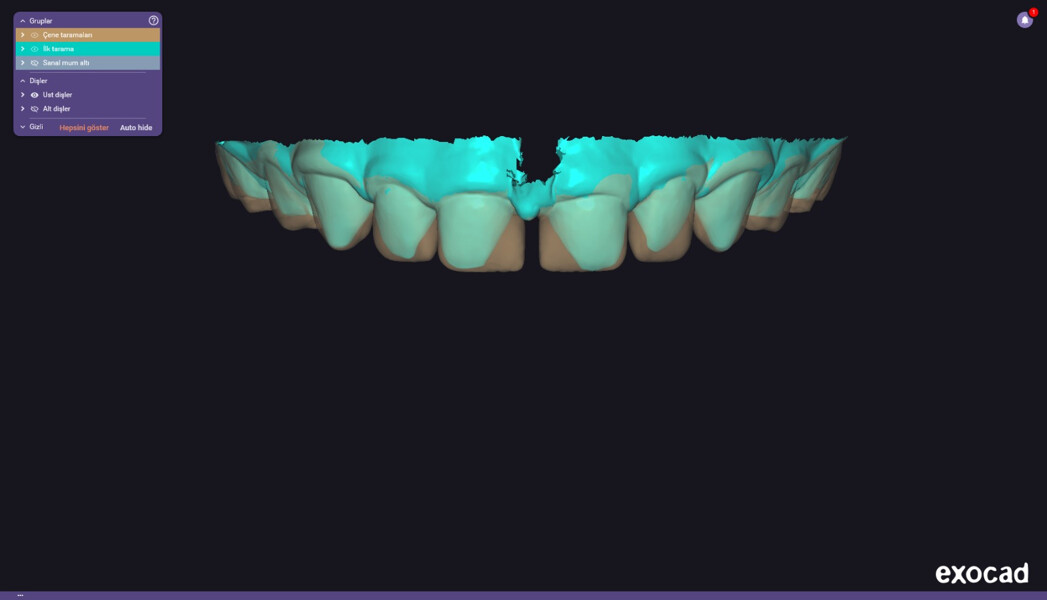 Fig. 2d