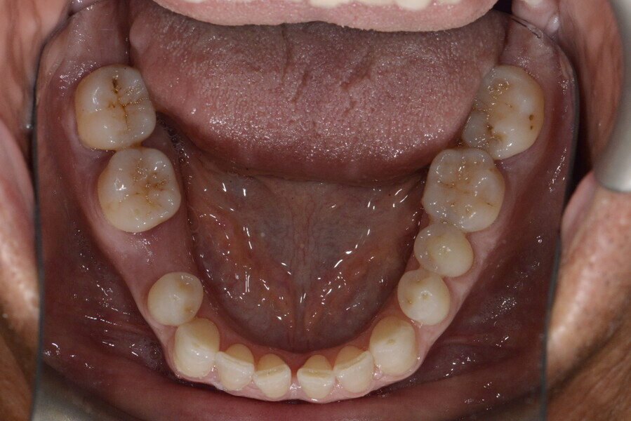 Fig. 12b