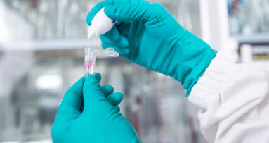 Researchers detect lead contamination in children’s primary teeth