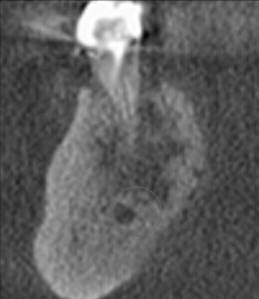 Fig. 11e