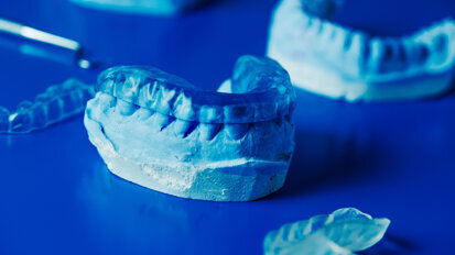Twenty-four-hour turnaround for in-house occlusal splint fabrication for a patient with parafunctional habits and premature wear