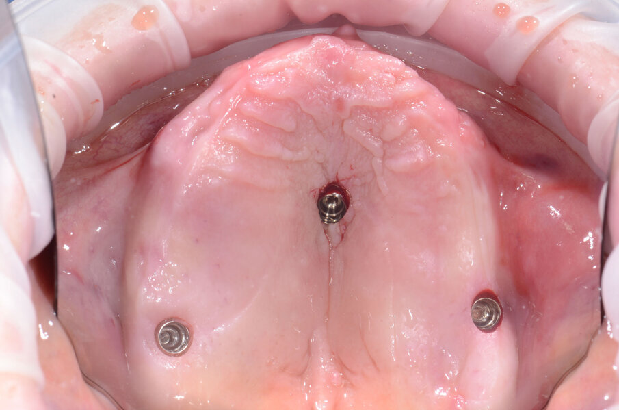 Fig. 6