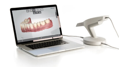 3Shape, flujo digital completo para restauraciones
