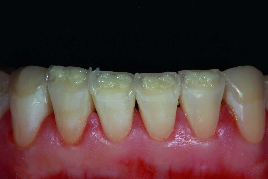 Fig.27