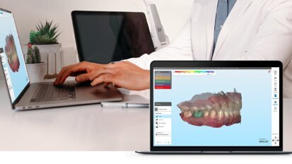 Align Technology presenta iTero Design Suite, la funzionalità di progettazione intuitiva per la stampa 3D in studio
