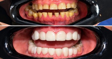 El paciente quería una bonita sonrisa, pero el diagnóstico reveló algo más