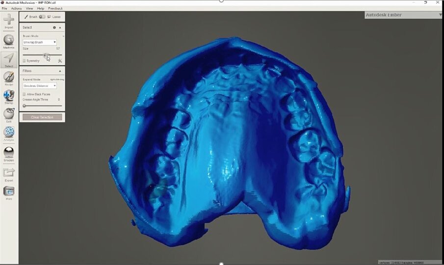 Fig. 9_Selezione della superficie, software free Meshmixer.