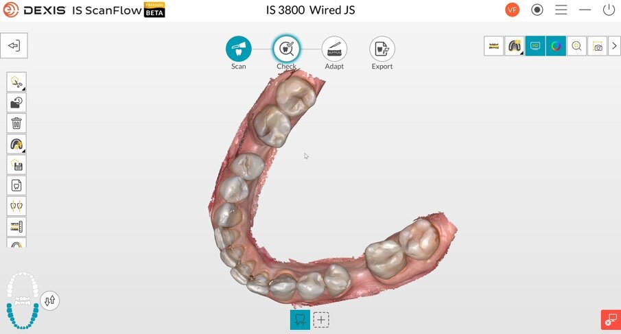 Fig. 4b