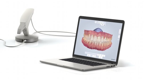 La solution d'empreinte numérique TRIOS Color de 3Shape inclut désormais une fonctionnalité de mesure des teintes dentaires
