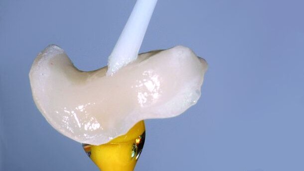 Silane coupling agents and surface conditioning in dentistry