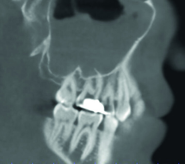 Fig.: 5