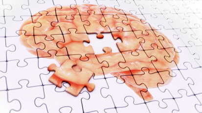 Study confirms gingival recession increases risk of Alzheimer’s disease