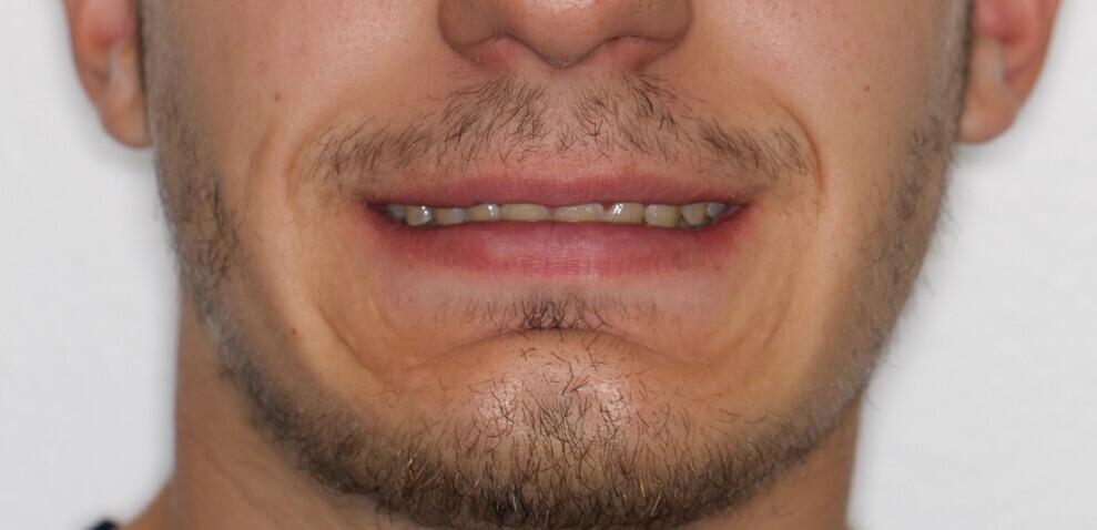 Fig. 1: Extra-oral photograph.