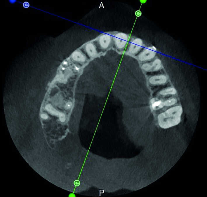 Figure 31