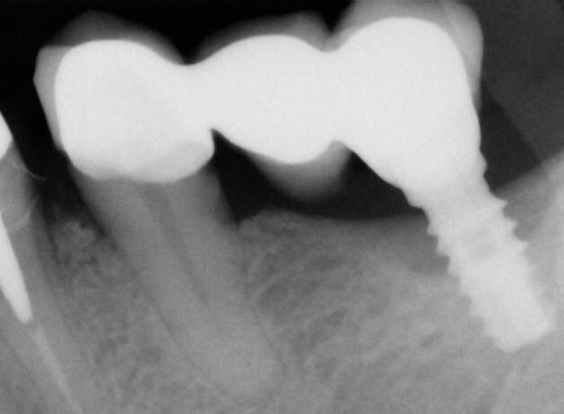 Fig. 9