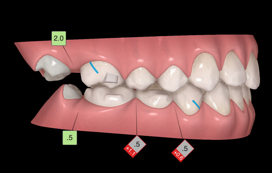 Fig. 31