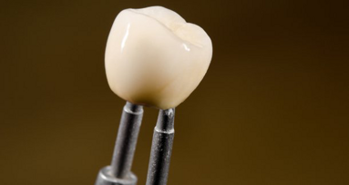 Investigan el desgaste de las coronas cerámicas en los dientes primarios
