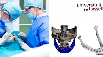 Erstes Kiefertransplantat mit 3D-Drucker hergestellt